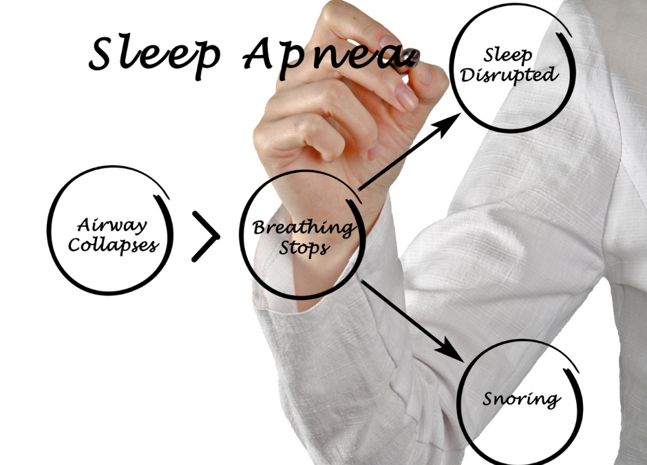 How is Sleep Apnea Measured?