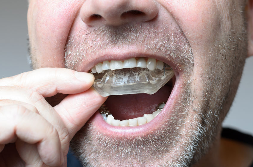 Bruxism (Teeth Grinding)