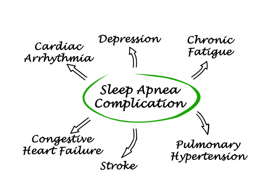 What Happens If You Don’t Treat Sleep Apnea?